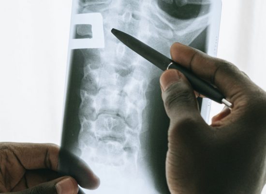 Radioprotezione per altro personale medico (MP9)